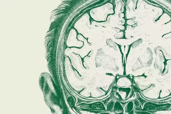 Navigating AI's Impact on Higher Education: A Critical Dialogue