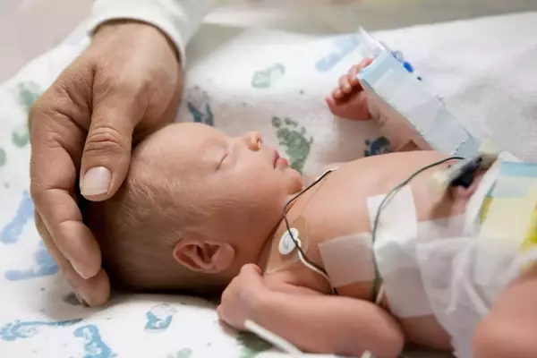 Understanding SSI Benefits for Premature Babies: A Comprehensive Guide
